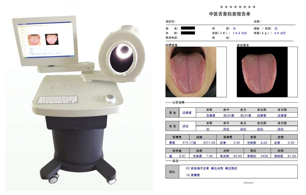 中医舌诊图像分析系统 HD/ZJ-1A